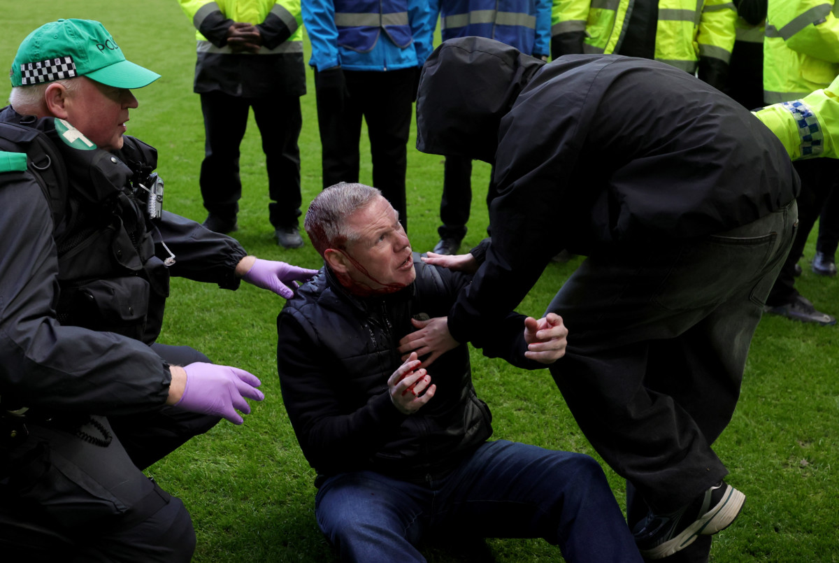 An injured man receives medical attention